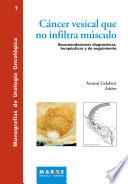 libro Cáncer Vesical Que No Infiltra Músculo